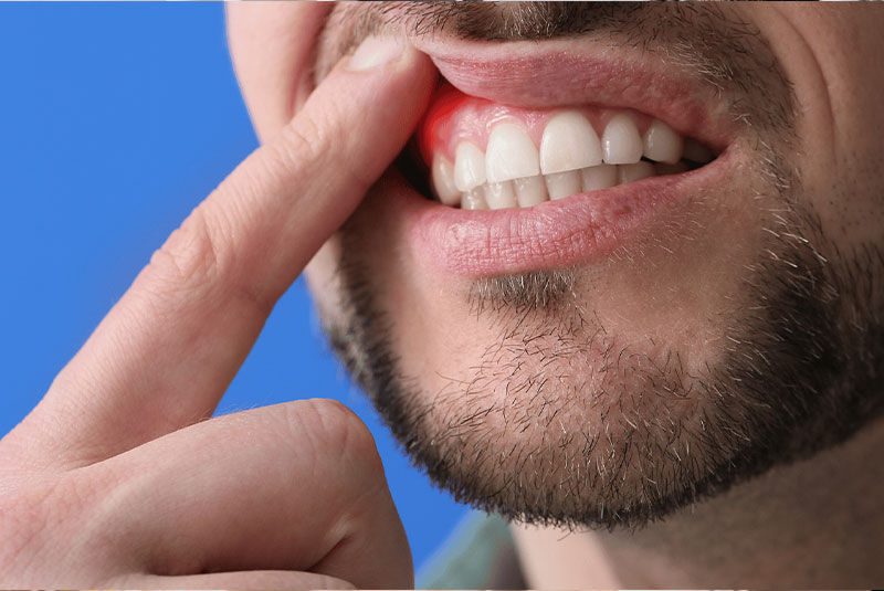 close up of person gum